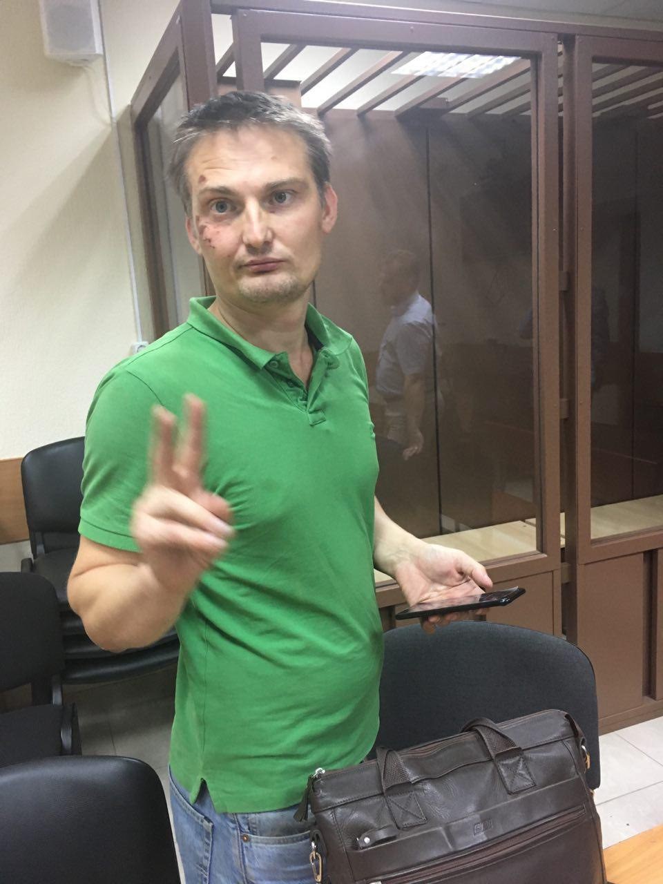 Der russische Anwalt Mikhail Benyash nach seiner Inhaftierung mit Schürfwunden und Prellungen an seinem Kopf