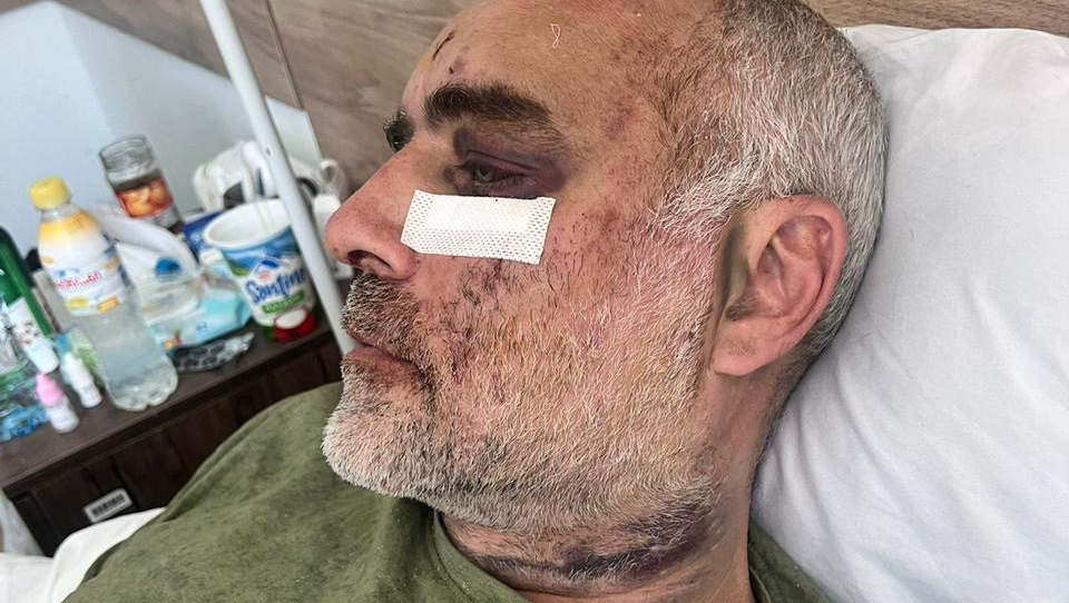 Das Bild zeigt einen Mann, der in einem Krankenhausbett liegt, er hat ein blaues Auge und Kratzer im Gesicht