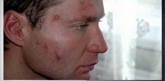 Dmytro Karpenko wurde von Polizisten misshandelt