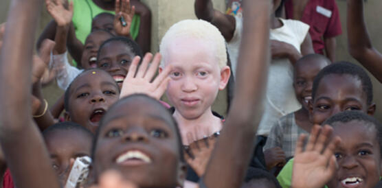 Annie Alfred muss wegen eines Aberglaubens in Malawi fürchten, aufgrund ihres Albinismus verfolgt zu werden 