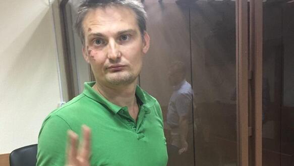Der russische Anwalt Mikhail Benyash nach seiner Inhaftierung mit Schürfwunden und Prellungen an seinem Kopf
