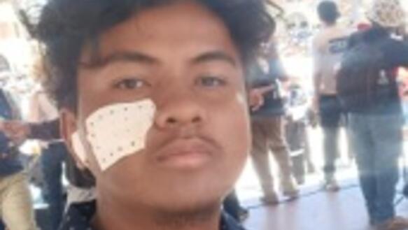 Das Bild zeigt einen jungen Mann, auf der rechten Wange trägt er ein Pflaster