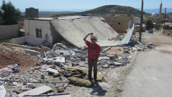 Dieser zehnjährige Junge wurde Ende August bei einem Bombenangriff in der Region Jabal al-Zawiya, Syrien, verletzt