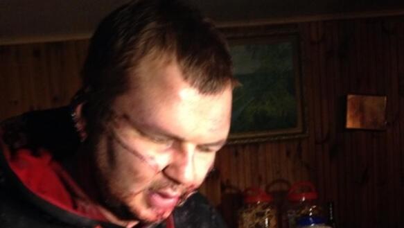 Der Aktivist Dmitrii Bulatov wurde entführt und gefoltert