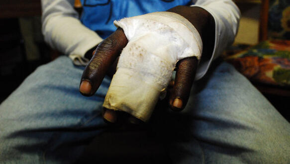 Opfer von Gewalt in Simbabwe.